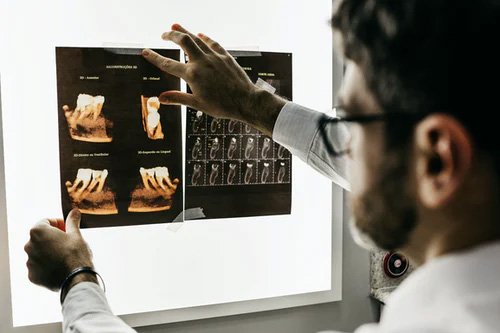 A doctor inspecting the Dental X-Ray Are they Safe during Pregnancy