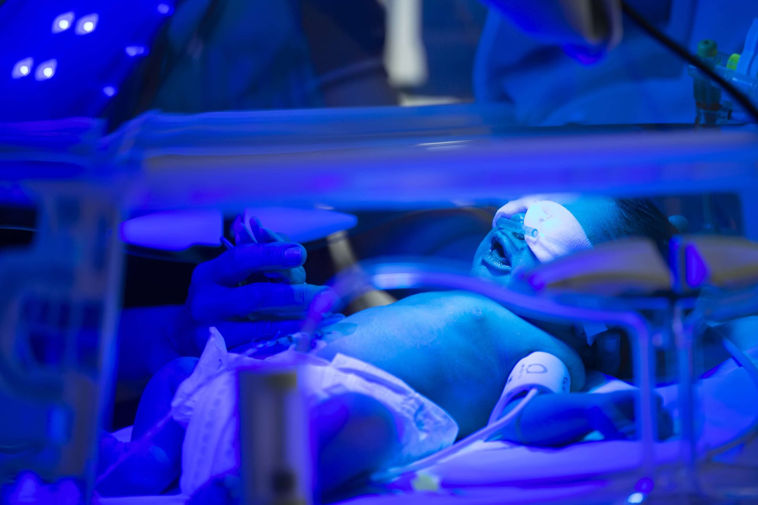 Preemies in a incubator