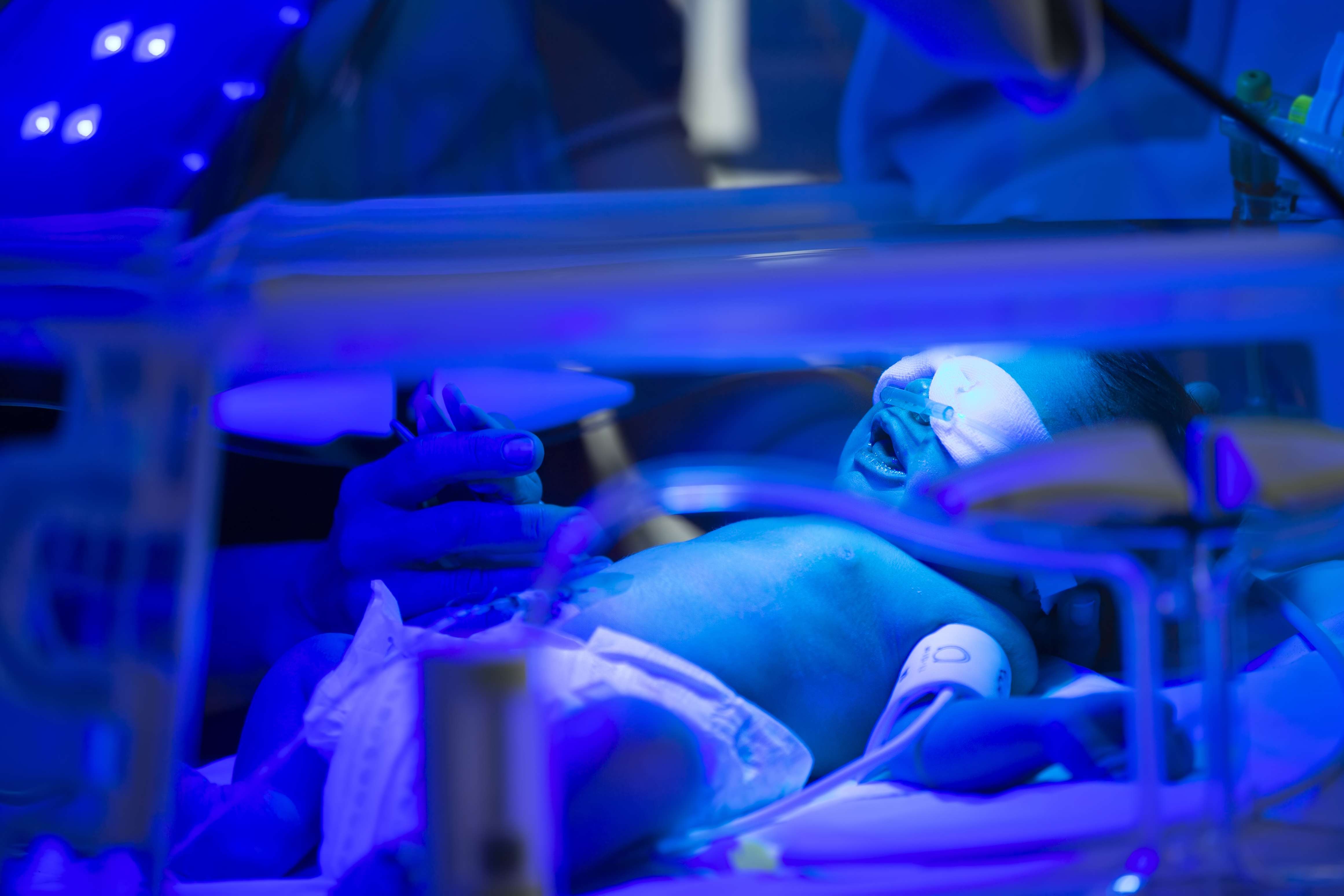 Preemies in a incubator