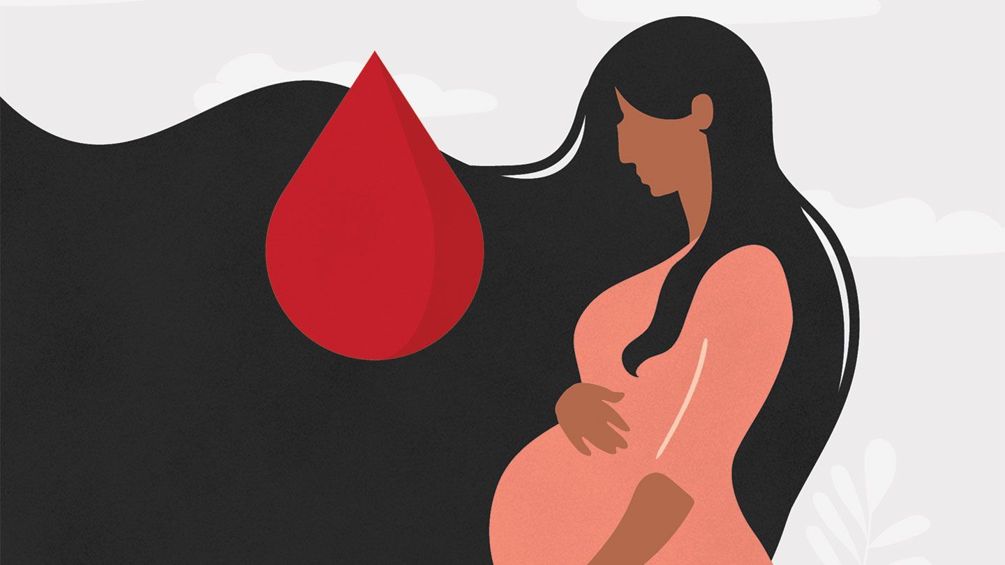 Pregnancy loss art