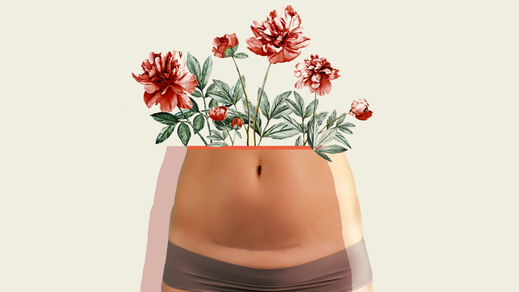 C section woman with scar and flowers in the place of her torso