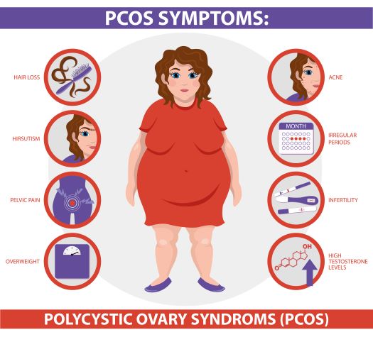 PCOS Symptoms infographic