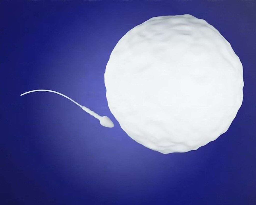 Male infertility