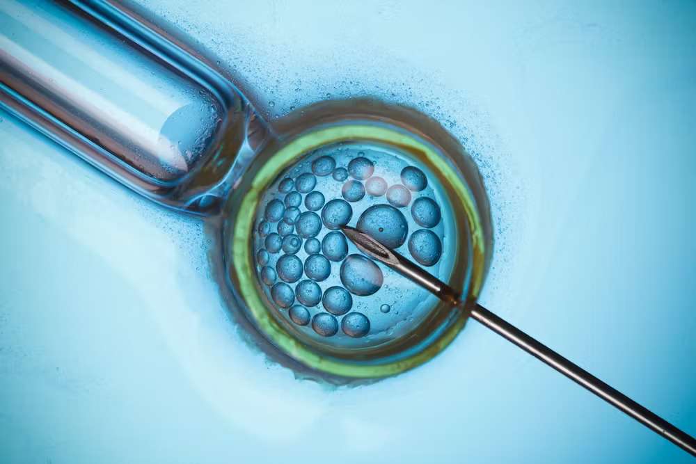 IVF and ectopic pregnancy - decoding the correlation! 
