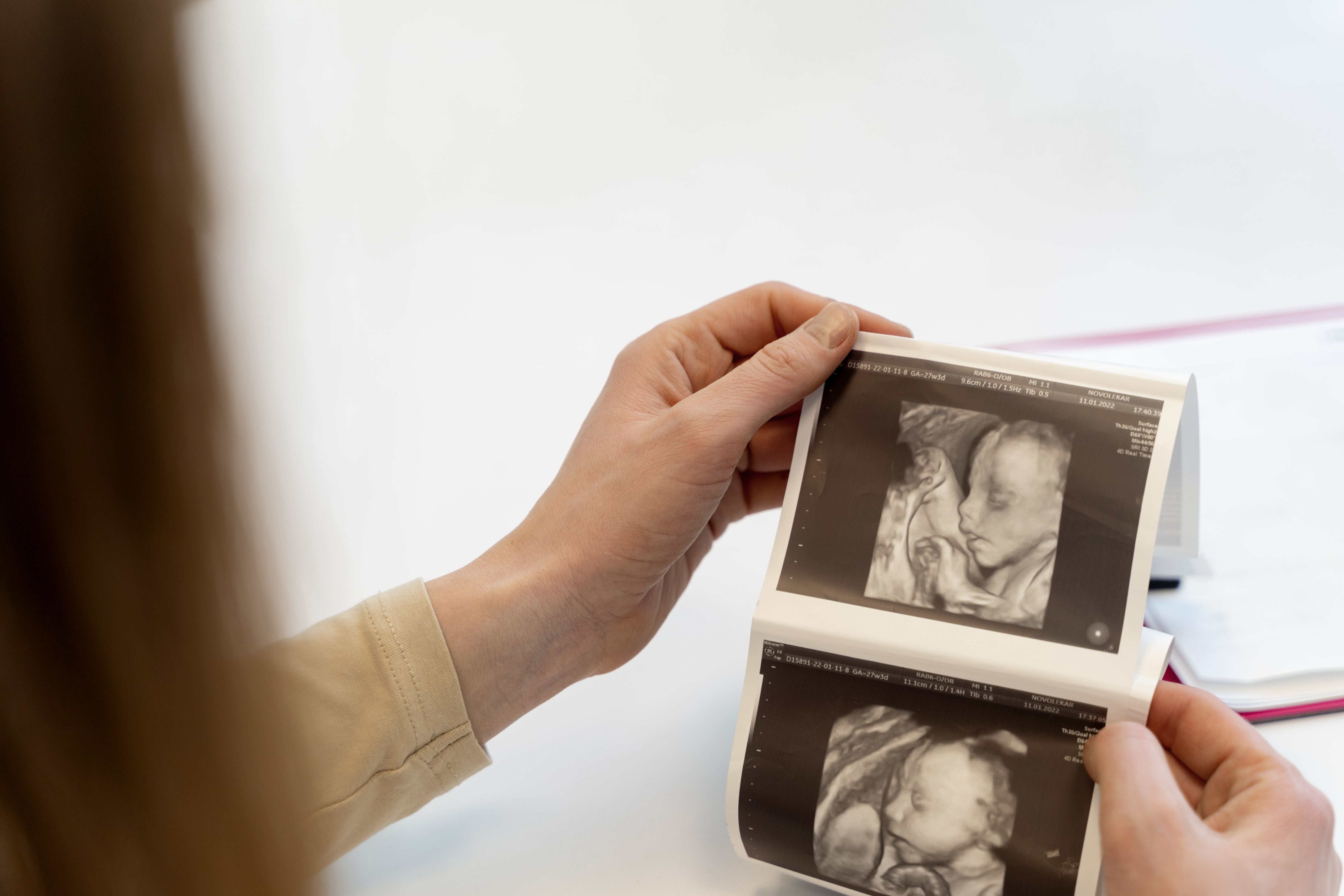 How is a Fetal Anomaly Scan Done?