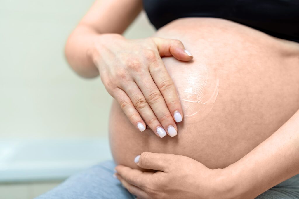 Dealing with Itchy Stretch Marks During Pregnancy